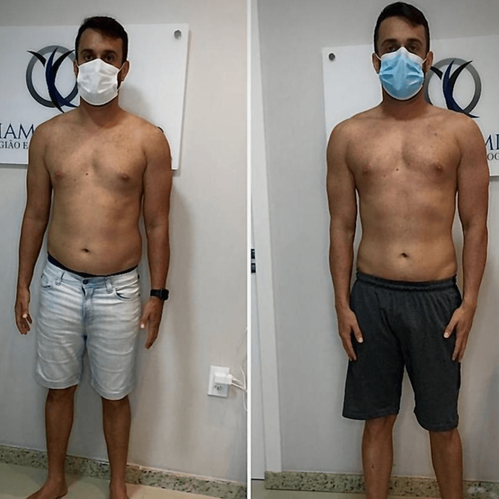 resultado nutrológo