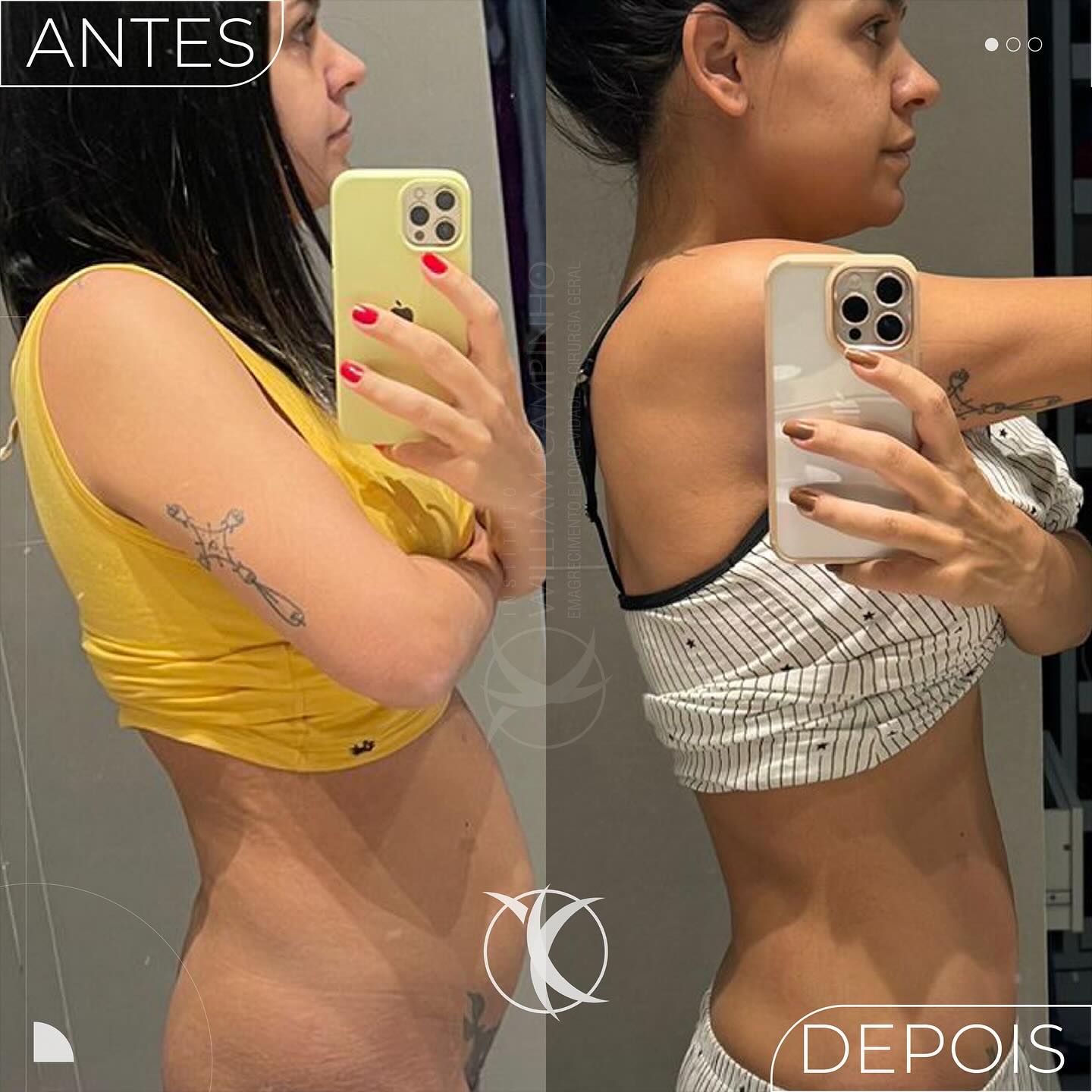 473910862_18049578443157033_1258787689296542411_n